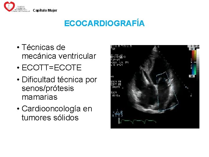 Capítulo Mujer ECOCARDIOGRAFÍA • Técnicas de mecánica ventricular • ECOTT=ECOTE • Dificultad técnica por
