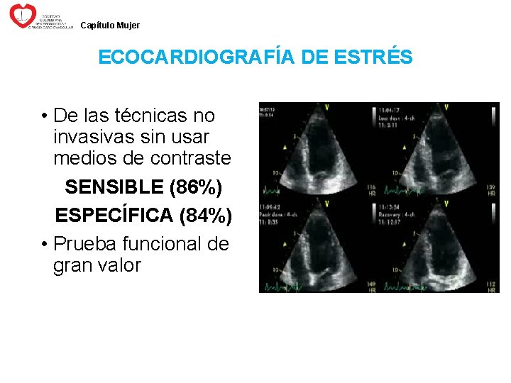 Capítulo Mujer ECOCARDIOGRAFÍA DE ESTRÉS • De las técnicas no invasivas sin usar medios