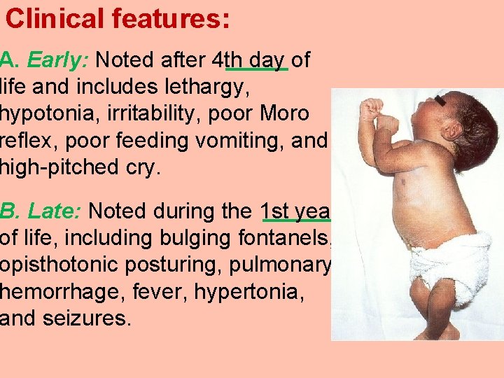 Clinical features: A. Early: Noted after 4 th day of life and includes lethargy,