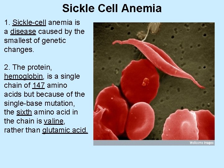 Sickle Cell Anemia 1. Sickle-cell anemia is a disease caused by the smallest of