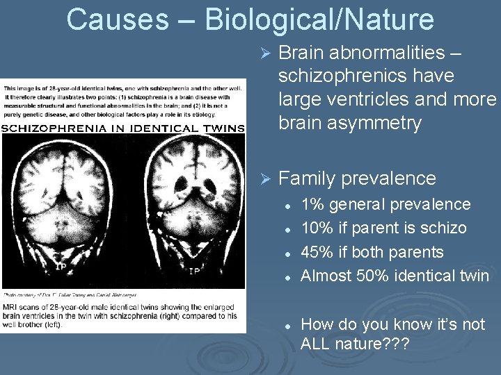 Causes – Biological/Nature Ø Brain abnormalities – schizophrenics have large ventricles and more brain