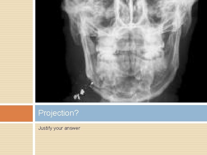 Projection? Justify your answer 