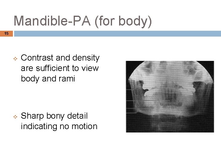 Mandible-PA (for body) 15 v v Contrast and density are sufficient to view body