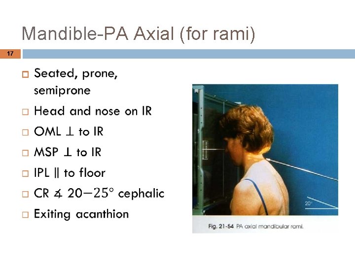 Mandible-PA Axial (for rami) 17 
