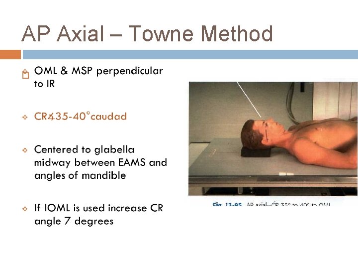 AP Axial – Towne Method 