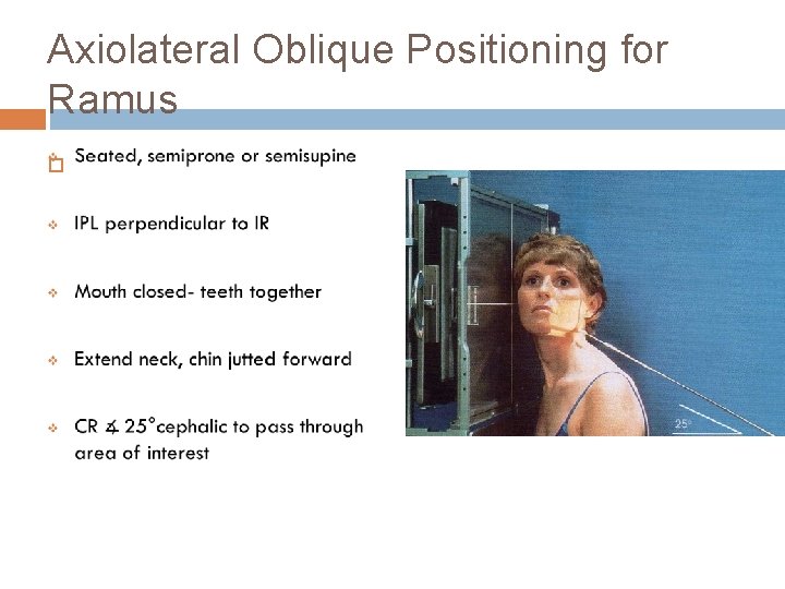 Axiolateral Oblique Positioning for Ramus 