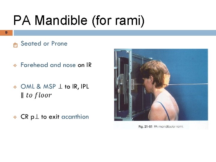 PA Mandible (for rami) 9 