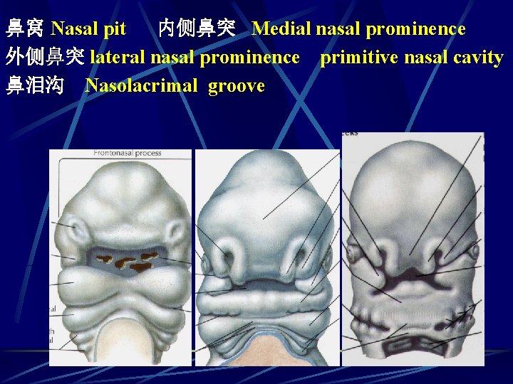 鼻窝 Nasal pit 内侧鼻突 Medial nasal prominence 外侧鼻突 lateral nasal prominence primitive nasal cavity