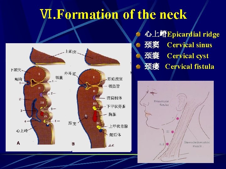 Ⅵ. Formation of the neck 心上嵴Epicardial ridge 颈窦 Cervical sinus 颈囊 Cervical cyst 颈瘘