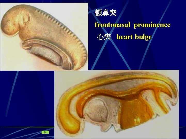 额鼻突 frontonasal prominence 心突 heart bulge 