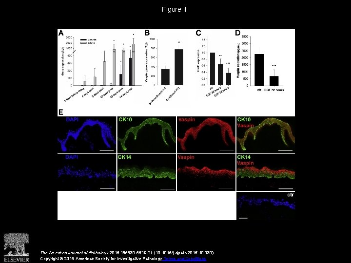 Figure 1 The American Journal of Pathology 2016 186639 -651 DOI: (10. 1016/j. ajpath.