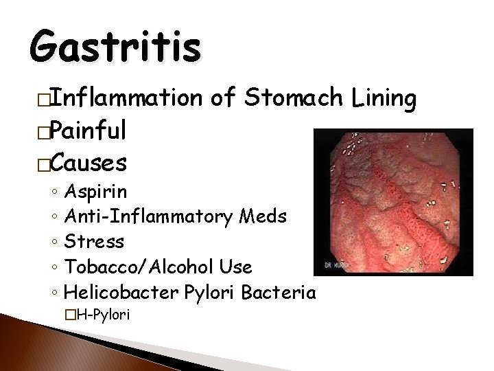 Gastrointestinal System CNA 2 Core Acute OSBN Curriculum
