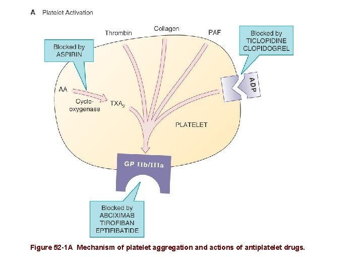 Figure 52 -1 A Mechanism of platelet aggregation and actions of antiplatelet drugs. 