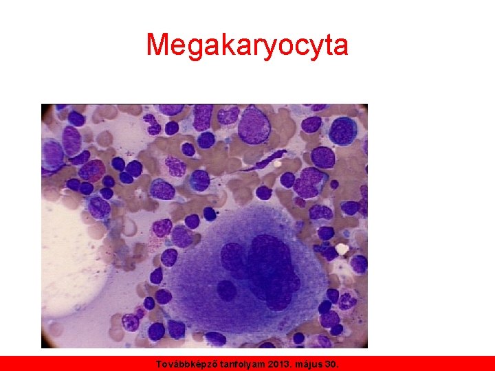 Megakaryocyta Továbbképző tanfolyam 2013. május 30. 