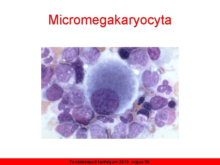 Micromegakaryocyta Továbbképző tanfolyam 2013. május 30. 