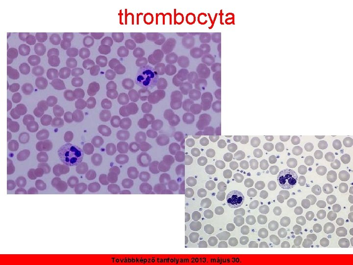 thrombocyta Továbbképző tanfolyam 2013. május 30. 