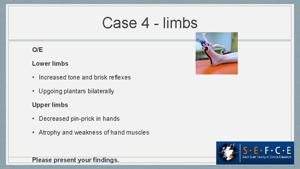 Case 4 - limbs O/E Lower limbs • Increased tone and brisk reflexes •