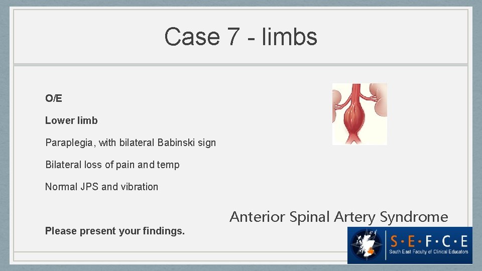 Case 7 - limbs O/E Lower limb Paraplegia, with bilateral Babinski sign Bilateral loss