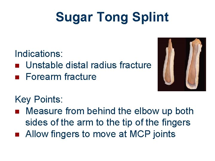 Splinting Immobilization Learning Objectives Appropriate immobilization