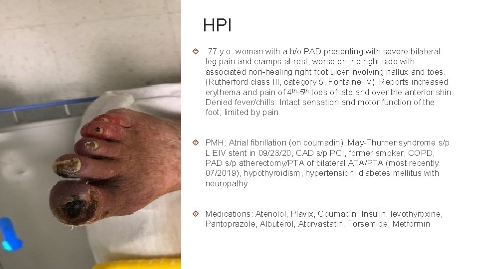 HPI 77 y. o. woman with a h/o PAD presenting with severe bilateral leg