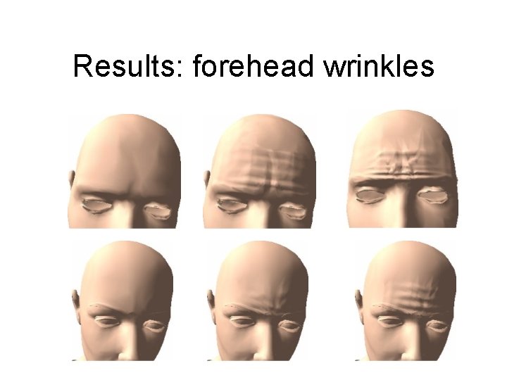 Results: forehead wrinkles 