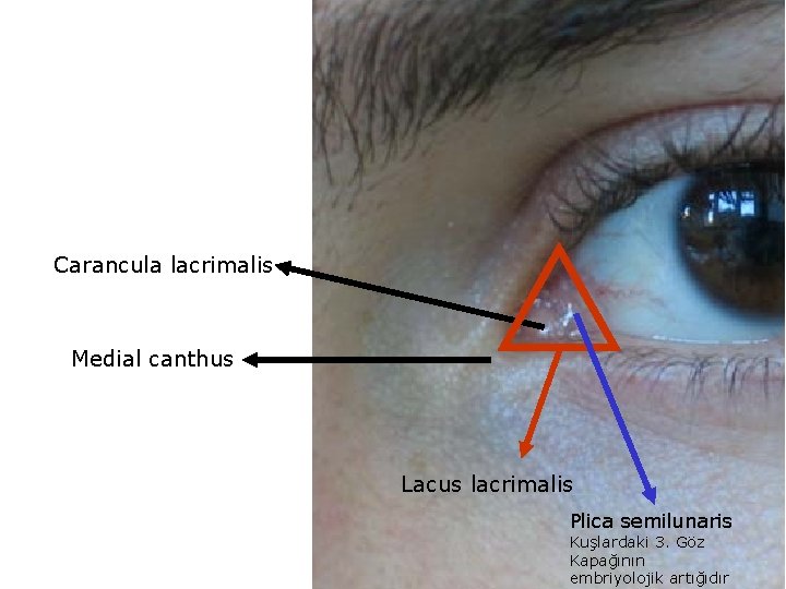 Carancula lacrimalis Medial canthus Lacus lacrimalis Plica semilunaris Kuşlardaki 3. Göz Kapağının embriyolojik artığıdır