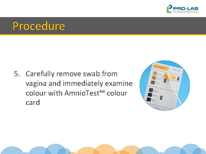 Procedure 5. Carefully remove swab from vagina and immediately examine colour with Amnio. Test™