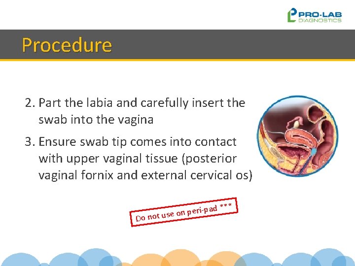 Procedure 2. Part the labia and carefully insert the swab into the vagina 3.