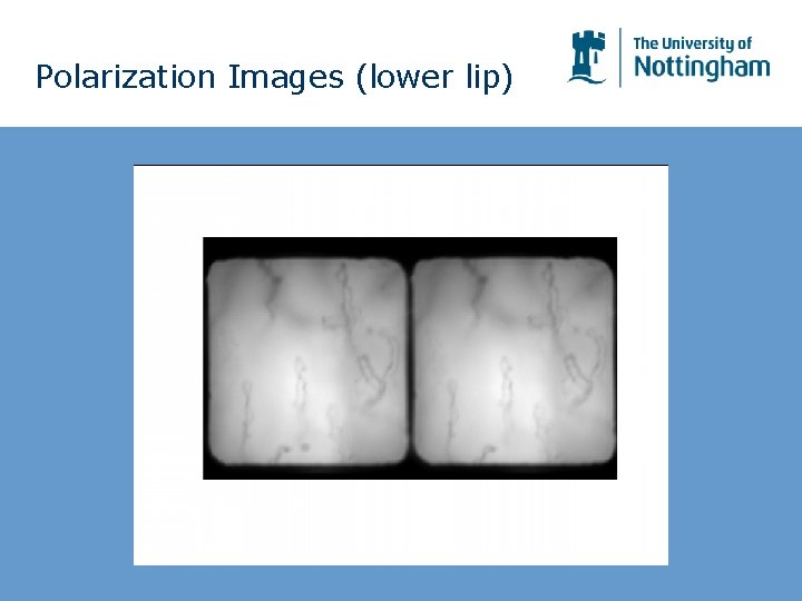 Polarization Images (lower lip) Polarization Images (lower lip)