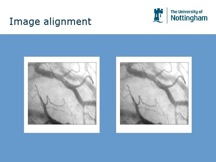 Image alignment Image alignment