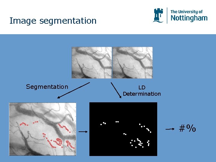 Image segmentation Segmentation LD Determination #% Image segmentation Segmentation LD Determination #%