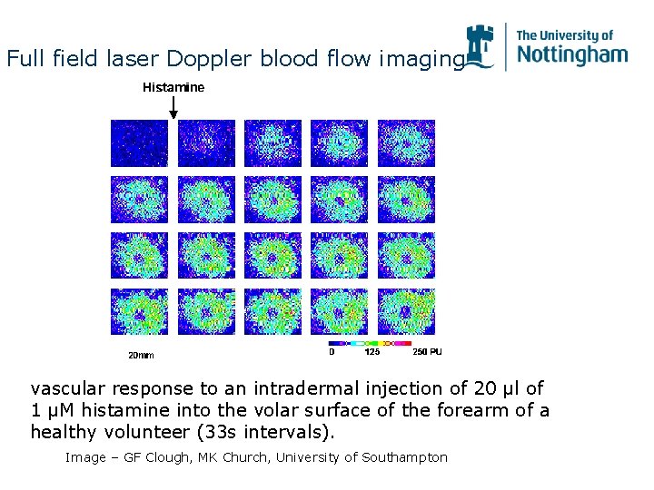 Full field laser Doppler blood flow imaging vascular response to an intradermal injection of Full field laser Doppler blood flow imaging vascular response to an intradermal injection of