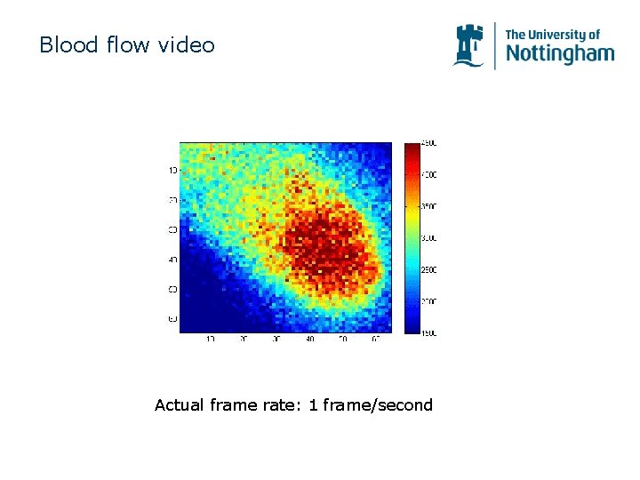 Blood flow video Actual frame rate: 1 frame/second Blood flow video Actual frame rate: 1 frame/second