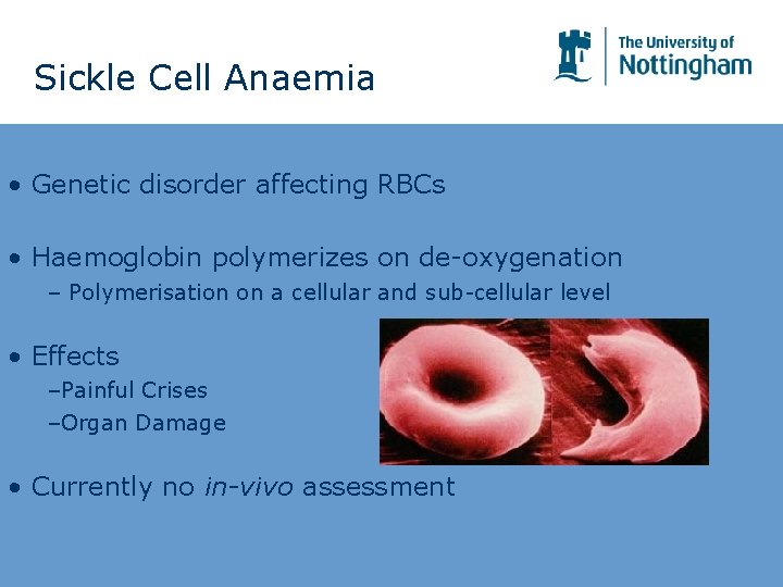 Sickle Cell Anaemia • Genetic disorder affecting RBCs • Haemoglobin polymerizes on de-oxygenation – Sickle Cell Anaemia • Genetic disorder affecting RBCs • Haemoglobin polymerizes on de-oxygenation –