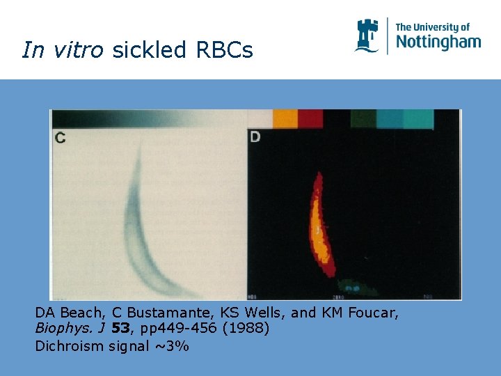 In vitro sickled RBCs DA Beach, C Bustamante, KS Wells, and KM Foucar, Biophys. In vitro sickled RBCs DA Beach, C Bustamante, KS Wells, and KM Foucar, Biophys.