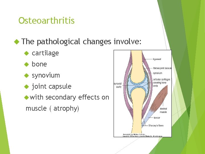 Osteoarthritis The pathological changes involve: cartilage bone synovium joint capsule with secondary effects on