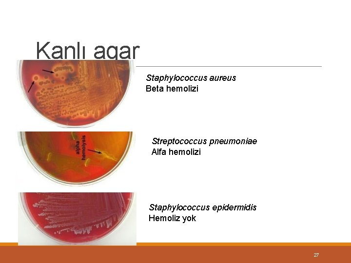 Kanlı agar Staphylococcus aureus Beta hemolizi Streptococcus pneumoniae Alfa hemolizi Staphylococcus epidermidis Hemoliz yok