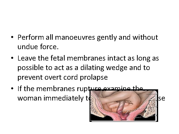  • Perform all manoeuvres gently and without undue force. • Leave the fetal
