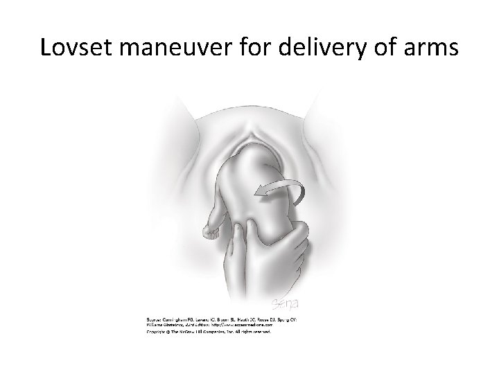 Lovset maneuver for delivery of arms 