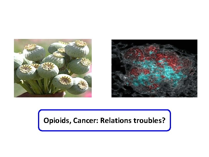 Opioids, Cancer: Relations troubles? 