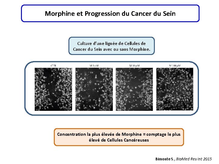 Morphine et Progression du Cancer du Sein Culture d’une lignée de Cellules de Cancer