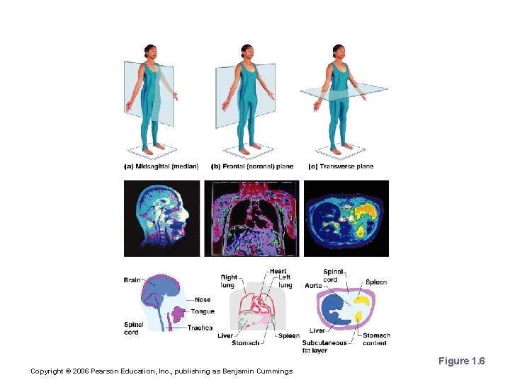 Body Planes Figure 1. 6 Copyright © 2006 Pearson Education, Inc. , publishing as