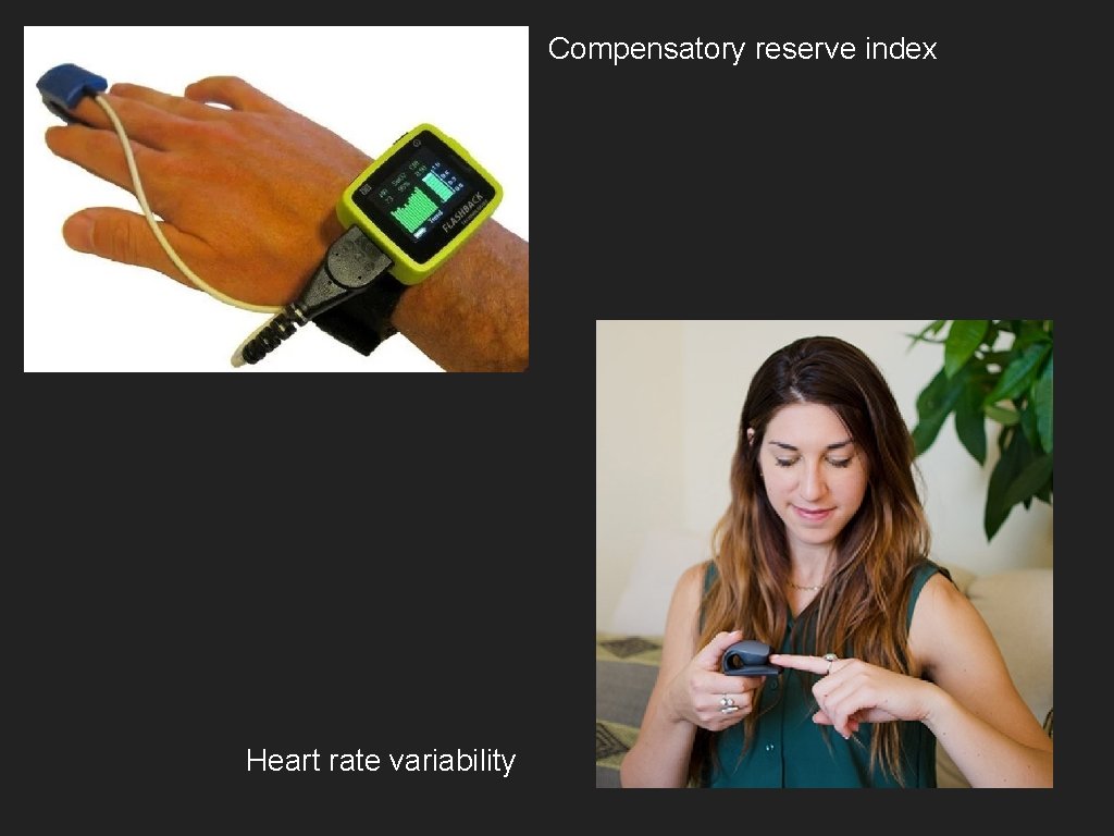 Compensatory reserve index Heart rate variability 