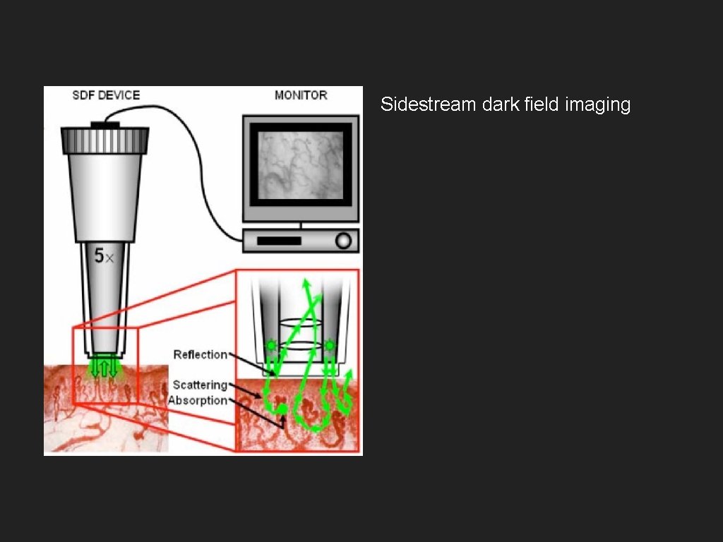 Sidestream dark field imaging 
