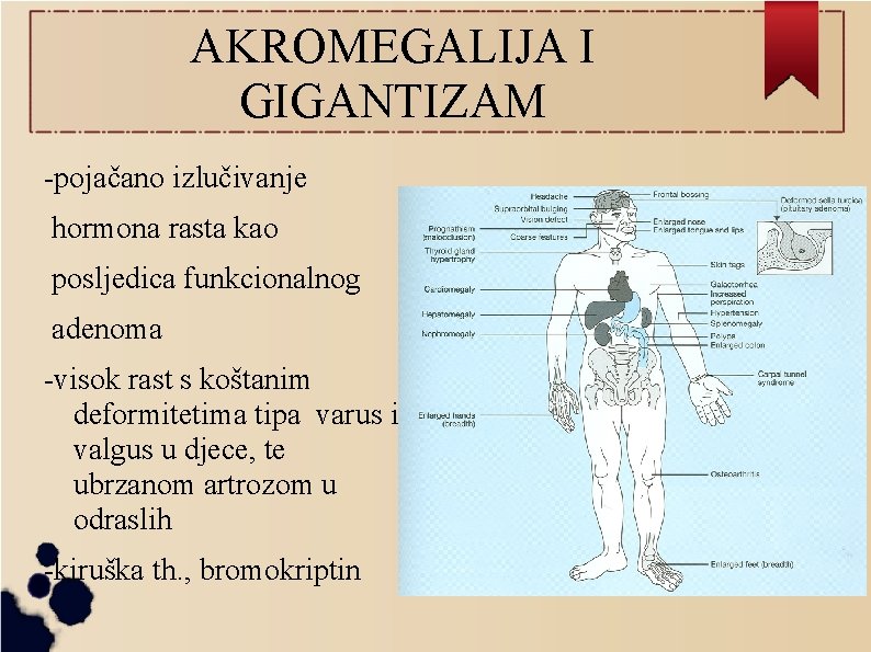 AKROMEGALIJA I GIGANTIZAM -pojačano izlučivanje hormona rasta kao posljedica funkcionalnog adenoma -visok rast s