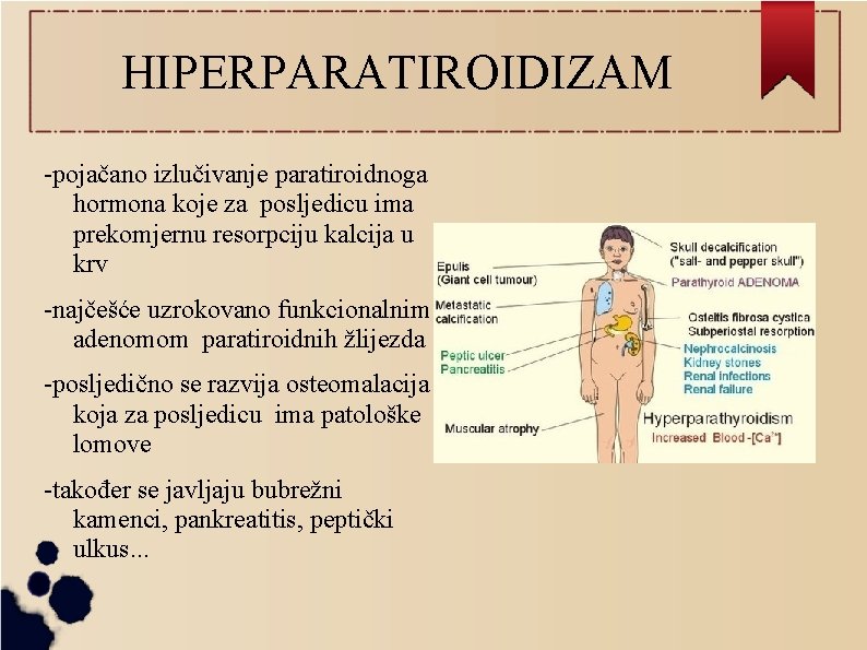 HIPERPARATIROIDIZAM -pojačano izlučivanje paratiroidnoga hormona koje za posljedicu ima prekomjernu resorpciju kalcija u krv