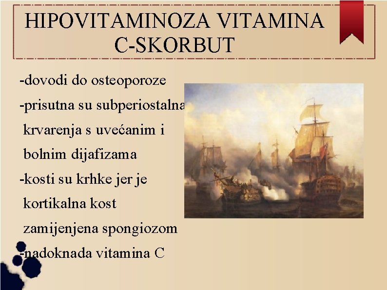 HIPOVITAMINOZA VITAMINA C-SKORBUT -dovodi do osteoporoze -prisutna su subperiostalna krvarenja s uvećanim i bolnim