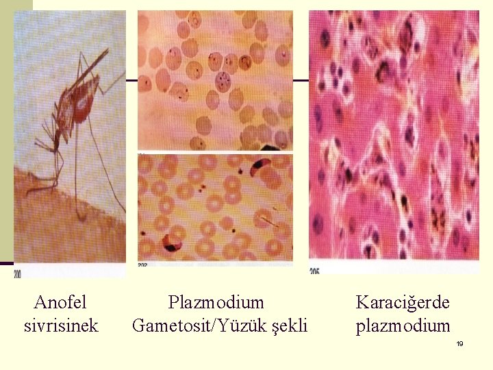 Anofel sivrisinek Plazmodium Gametosit/Yüzük şekli Karaciğerde plazmodium 19 