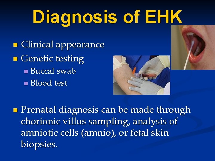 Diagnosis of EHK Clinical appearance n Genetic testing n Buccal swab n Blood test Diagnosis of EHK Clinical appearance n Genetic testing n Buccal swab n Blood test