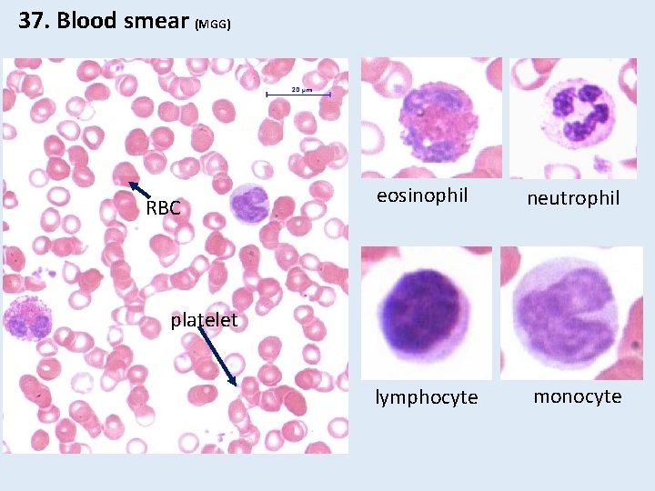 37. Blood smear (MGG) RBC eosinophil neutrophil lymphocyte monocyte platelet 